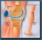 A Bakers Cyst is a collection of fluid behind the knee that often causes calf muscle pain