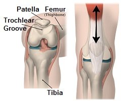 The patella (kneecap) sits in the trochlear groove on the front of the femur (thigh bone). As the knee moves, it glides up and down the groove