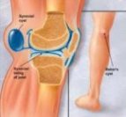 Exercises for specific knee conditions such as a Bakers Cyst.