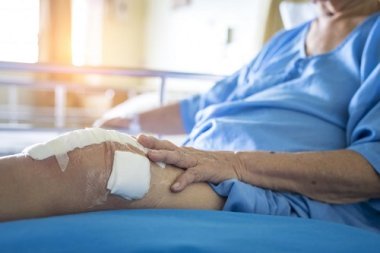 Common Problems after Knee Replacement - Knee Pain Explained