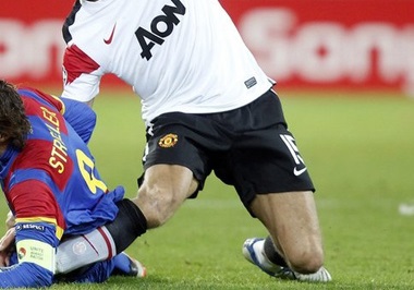 Direct contact accounts for 20% of ACL knee injuries. Find out about the symptoms, diagnosis and treatment Direct contact accounts for 20% of ACL knee injuries. Find out about the symptoms, diagnosis and treatment