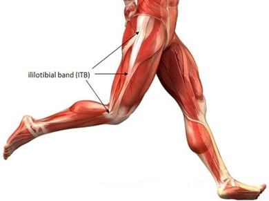 Iliotibial band syndrome (ITBS) can cause upper thigh pain on the outer side of the leg Iliotibial band syndrome (ITBS) can cause upper thigh pain on the outer side of the leg