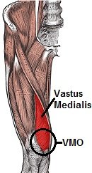 Vastus Medialis Muscle