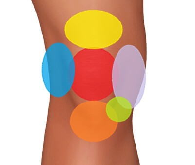 Anterior knee pain location chart - find out what is causing your knee pain Anterior knee pain location chart - find out what is causing your knee pain