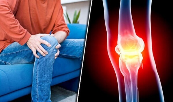 Arthritis Pain: Causes, Symptoms, Diagnosis & Treatment