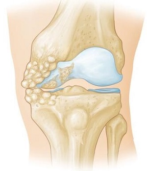 Large Inside Of Knee