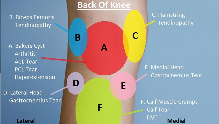 Knee Injury Chart