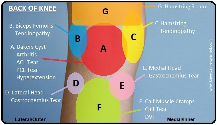 Knee Location Chart
