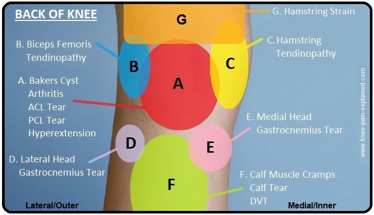 Knee Diagnosis Chart