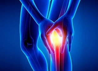 Burning Knee Pain: Causes, Symptoms & Treatment