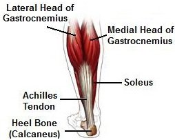 Calf Muscle Pain: Causes, Diagnosis, Symptoms & Treatment