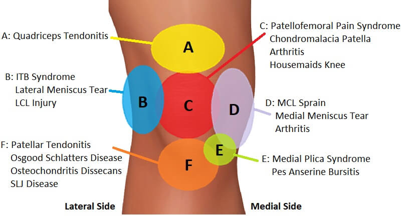 Knee Location Chart