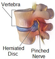 Burning Knee Pain Causes Symptoms