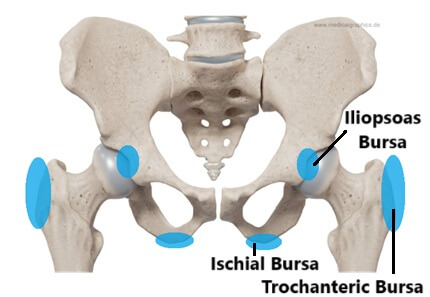 Hip Bursa: There are three main bursa around the hip - trochanteric bursa, iliopsoas bursa and ischial bursa. Inflammation of any of the hip bursa can cause pain