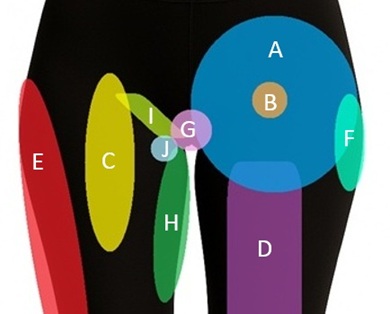 Hip Pain Location Diagram: Find out what is causing your hip pain