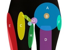 Hip Pain Location Diagram: Find out what is causing your hip pain and how to treat it.