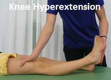 Hyperextended Knee: Causes, symptoms, diagnosis & treatment