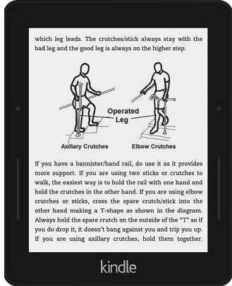 Interior view from our new knee arthritis book available in paperback and Ebook.  Knee Arthritis: Take Back Control Interior view from our new knee arthritis book available in paperback and Ebook.  Knee Arthritis: Take Back Control