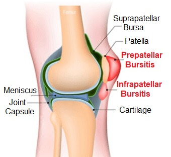 bursa suprapatellaris)