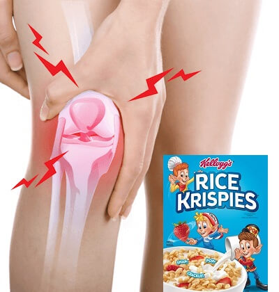 knee pain and popping 400 opt feb 25