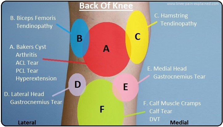 Knee Location Chart