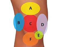 Knee Symptoms Chart