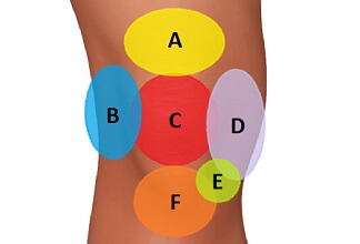 Types of knee pain deals