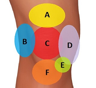 Knee Injury Diagnosis Chart