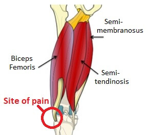 Knee Symptoms Chart