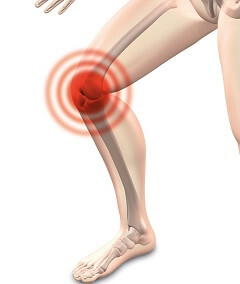 Medial Knee Pain Causes Treatment