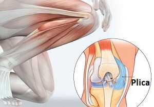 Medial Knee Pain Causes Treatment