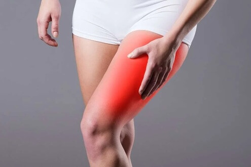 Meralgia Paresthetica: Causes, symptoms, diagnosis and treatment of Bernhardt Roth Syndrome Meralgia Paresthetica: Causes, symptoms, diagnosis and treatment of Bernhardt Roth Syndrome