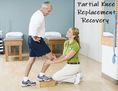 Partial Knee Replacement Recovery - what to expect and how to get the best results from your new knee