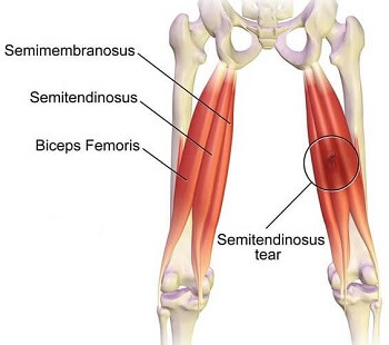 gracilis muscle origin