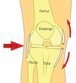 Large Inside Of Knee