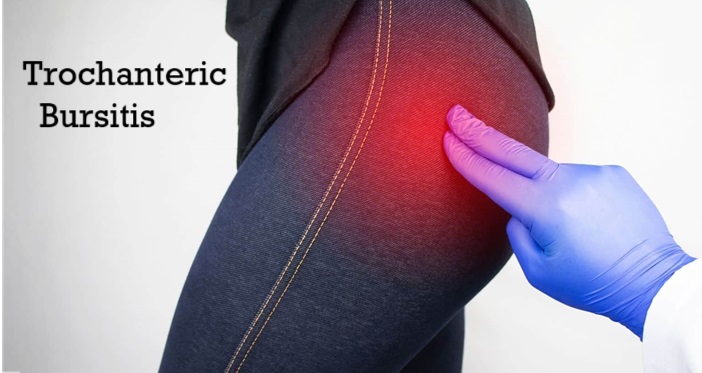 Trochanteric Bursitis Hip Pain: Causes, Symptoms, Diagnosis & Treatment Trochanteric Bursitis Hip Pain: Causes, Symptoms, Diagnosis & Treatment