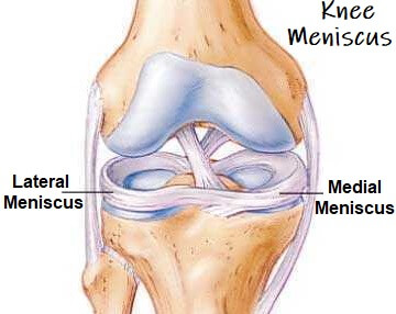 Knee Meniscus & Cartilage Knee Pain Explained