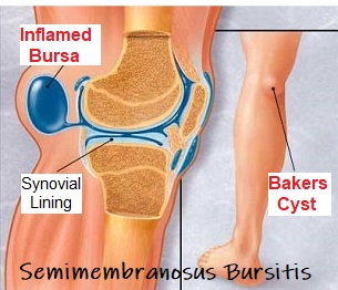 Knee Anatomy Bursae Sacs - Human Body Anatomy